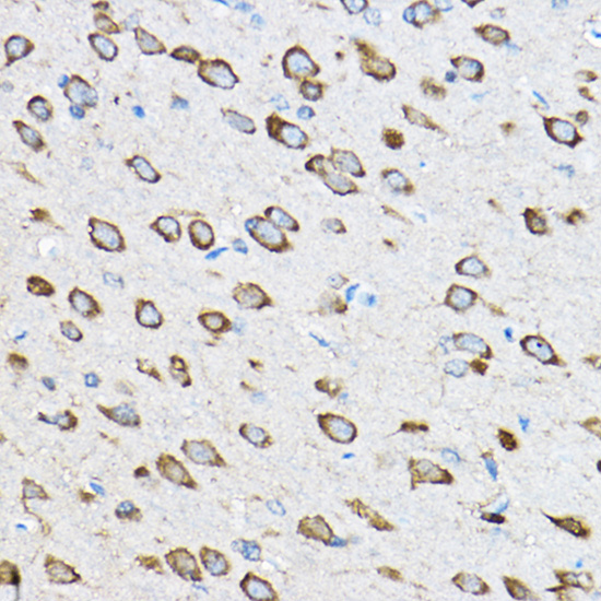 RPL23 Polyclonal Antibody[3054
