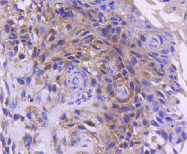 Cdk4 Rabbit mAb[49117]