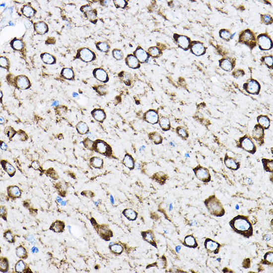RPL17 Polyclonal Antibody[3068