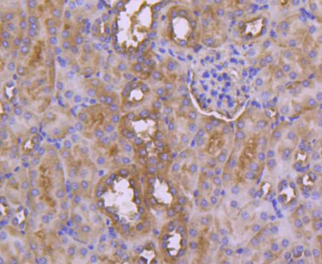 CD10 Rabbit mAb[49098]