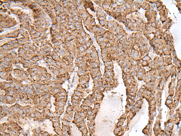 AP1S1 antibody[31849]