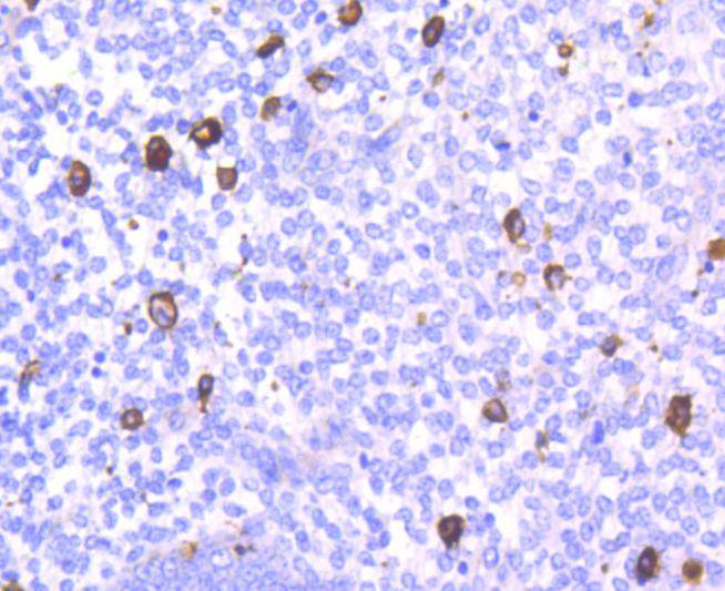 CD14 Rabbit mAb[49003]