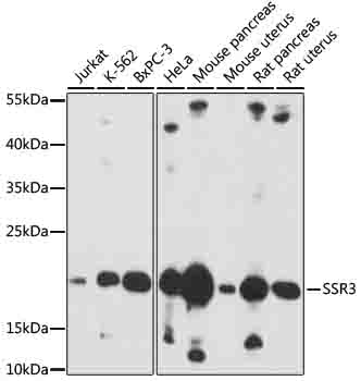 SSR3 Polyclonal Antibody[30215