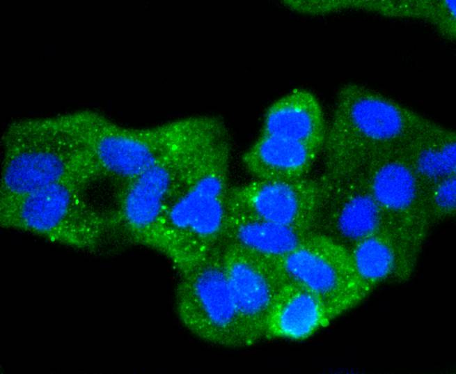 Pan-Cadherin Rabbit mAb[48907]
