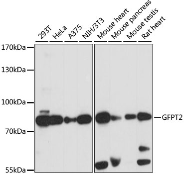 GFPT2 Polyclonal Antibody[2893