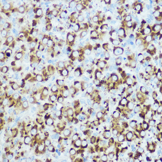 RSPO1 Polyclonal Antibody[3149