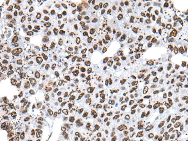 HNRNPR Antibody[46577]