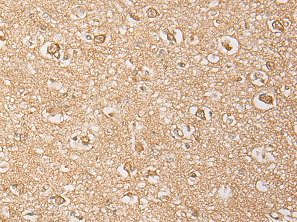 DGCR6 Antibody[47049]