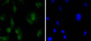 SOX11 Rabbit mAb[49190]
