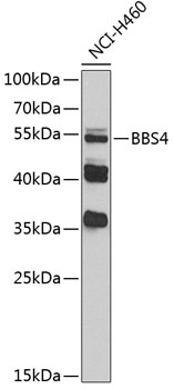 BBS4 Polyclonal Antibody[30482