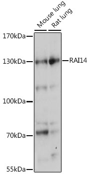 RAI14 Polyclonal Antibody[2943