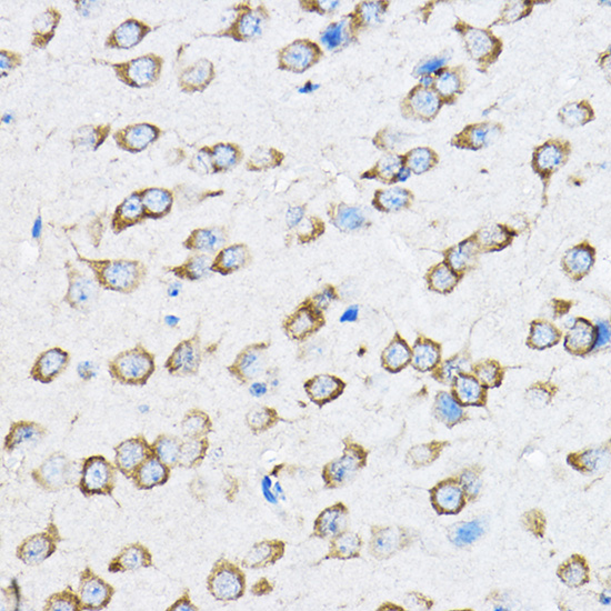 RPL23 Polyclonal Antibody[3054