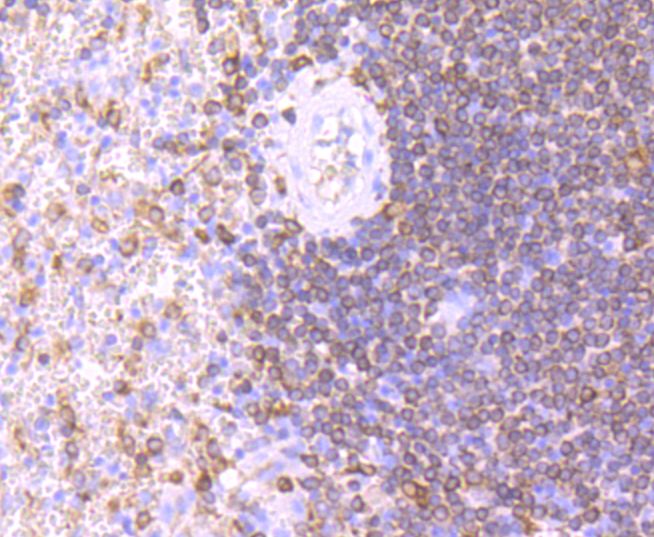CD74 Rabbit mAb[49365]