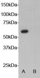 Autoimmune regulator Antibody[