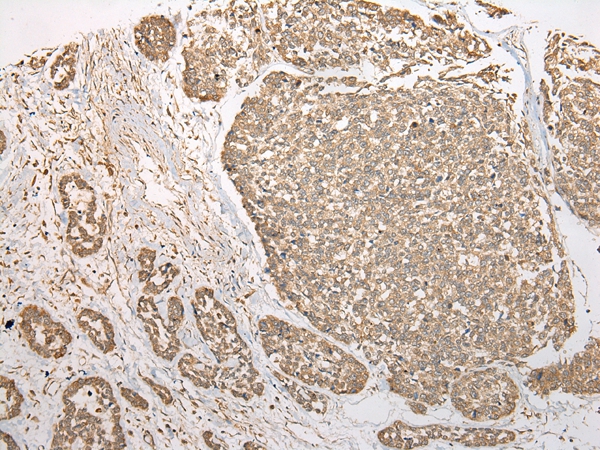 C21orf2 Antibody[46369]