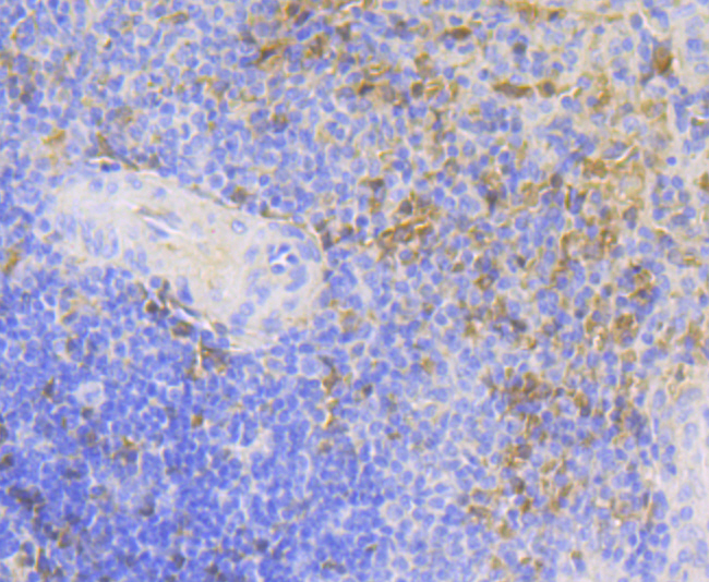 Carbonic Anhydrase I Rabbit mA