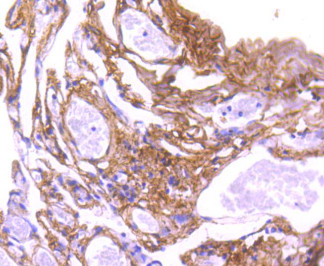 Collagen VI Rabbit mAb[49207]