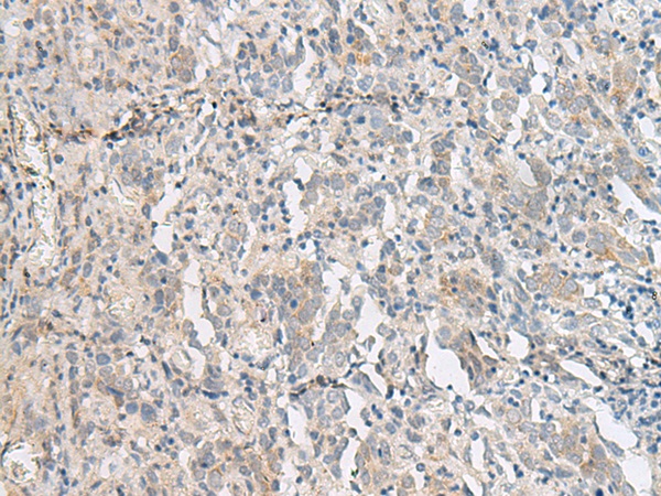 PCSK5 Antibody[47322]