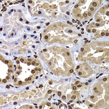 DNAJB6 Polyclonal Antibody[308