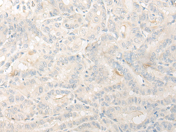 DNASE1L1 Antibody[47070]