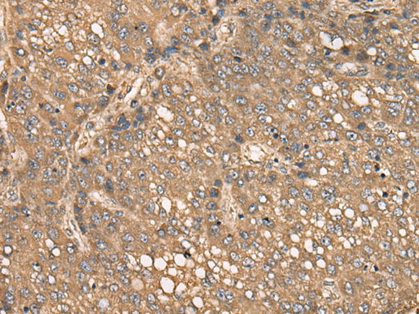 C4BPB Antibody[46374]