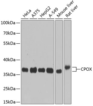 CPOX Polyclonal Antibody[30490