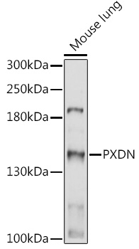 PXDN Polyclonal Antibody[30232