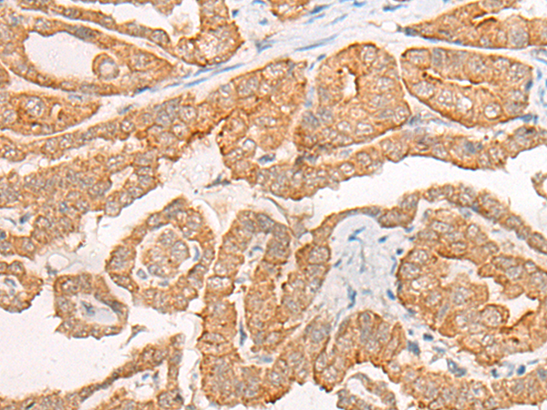 CYB5D1 Antibody[46997]