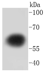 Tyrosine Hydroxylase Rabbit mA