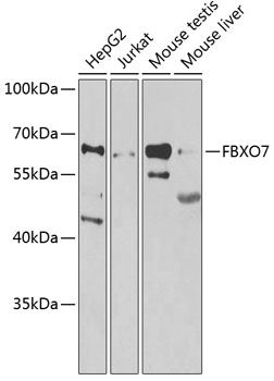 FBXO7 Polyclonal Antibody[3093