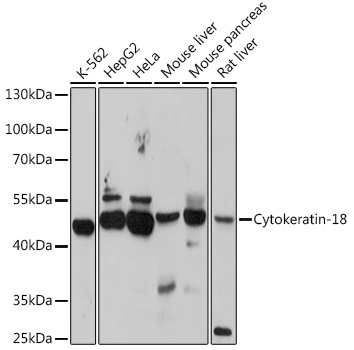 Cytokeratin-18 Polyclonal Anti