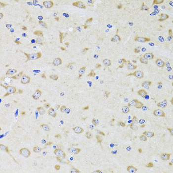 YWHAZ Polyclonal Antibody[3099