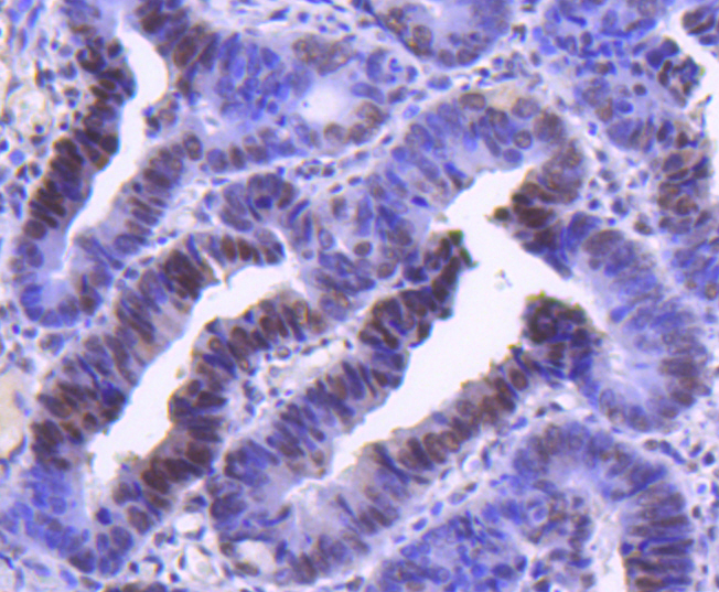Cyclin H Rabbit mAb[49100]