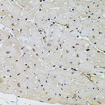 SET Polyclonal Antibody[29117]