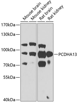 PCDHA13 Polyclonal Antibody[30