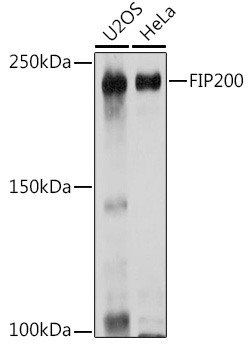RB1CC1 Polyclonal Antibody[286