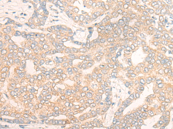 DENND5A Antibody[47046]