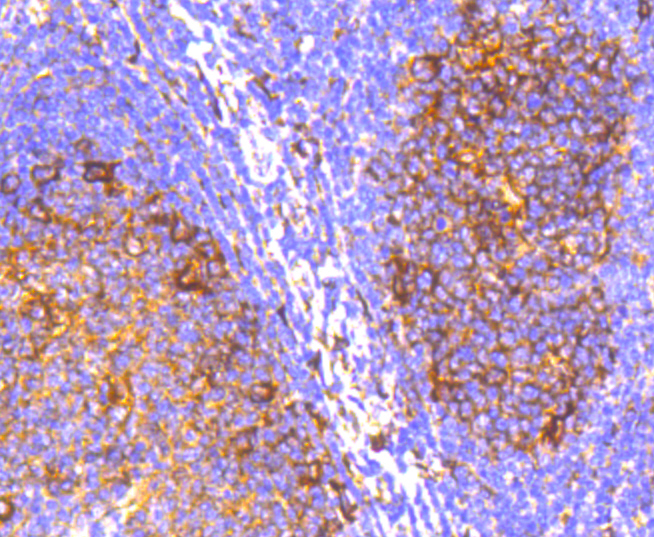 IRF7 Rabbit mAb[49007]