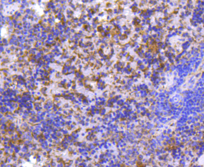 MMP11 Rabbit mAb[49045]