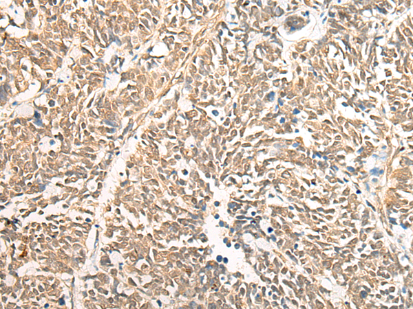DGCR6 Antibody[47049]