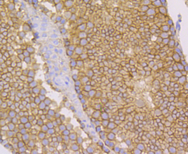 Nectin 2 Rabbit mAb[49959]