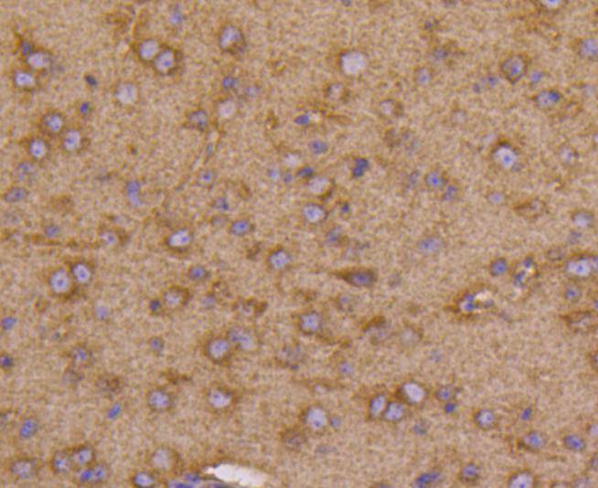 VEGF Receptor 1 Rabbit mAb[487