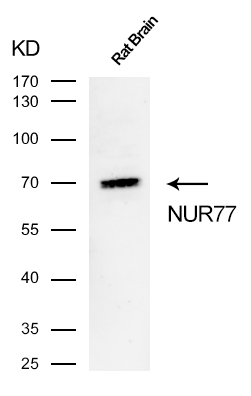 NUR77 Rabbit mAb[49510]