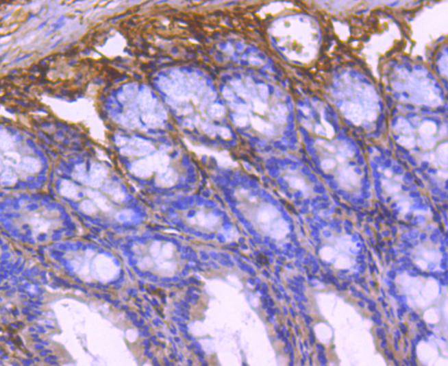 Collagen VI Rabbit mAb[49207]