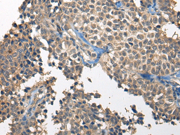 RCOR2 Antibody[46655]