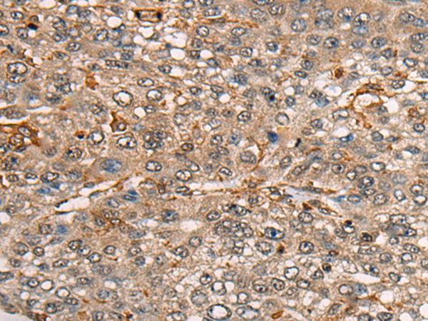 CDT1 Antibody[46460]