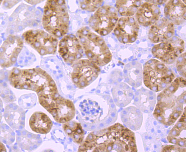 EGFR Rabbit mAb[48691]