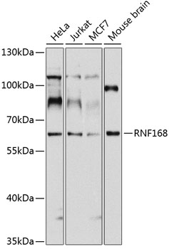 RNF168 Polyclonal Antibody[304