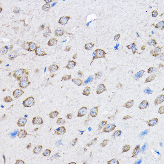 PTPN23 Polyclonal Antibody[305