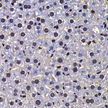 FIP1L1 Polyclonal Antibody[308